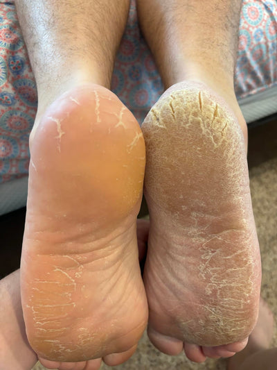 Review foto
